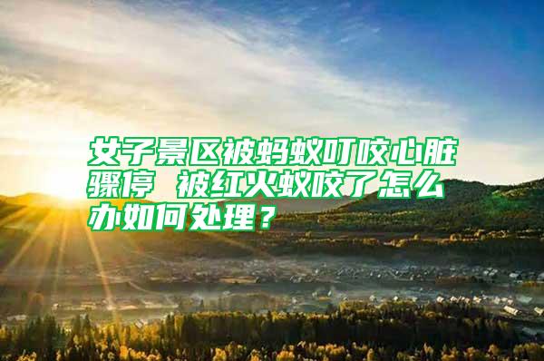 女子景區(qū)被螞蟻叮咬心臟驟停 被紅火蟻咬了怎么辦如何處理？